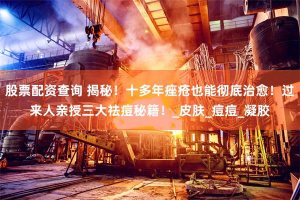 股票配资查询 揭秘！十多年痤疮也能彻底治愈！过来人亲授三大祛痘秘籍！_皮肤_痘痘_凝胶